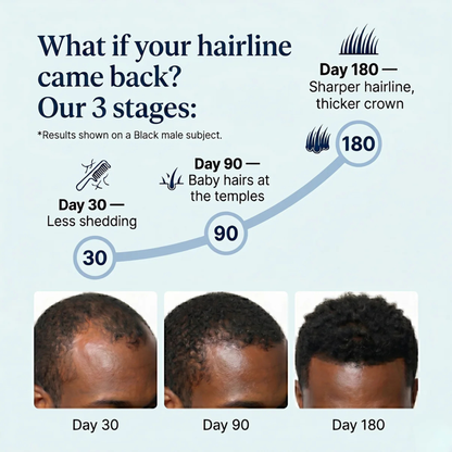 Aurévia Hair Growth Roll-on Serum